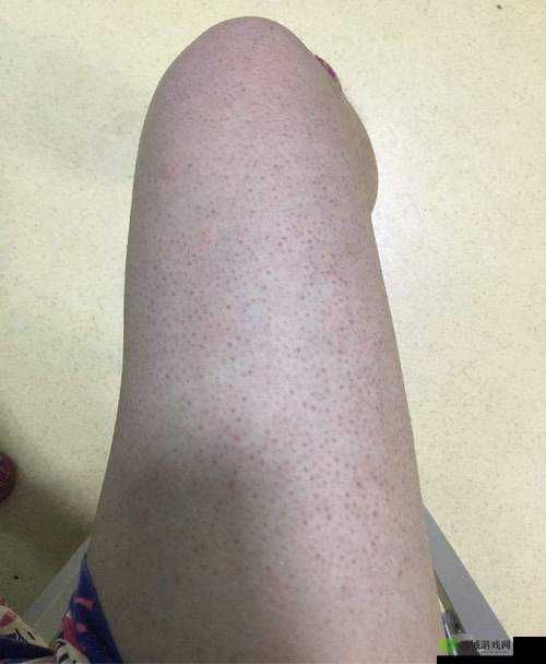 鸡皮疙瘩第关重生攻略:如何过关?