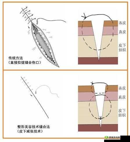 竹板打肿臂缝合不上：真的很离奇