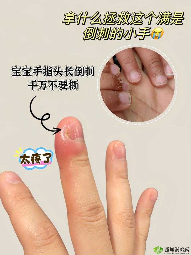 宝宝两根手指疼哭原因探究