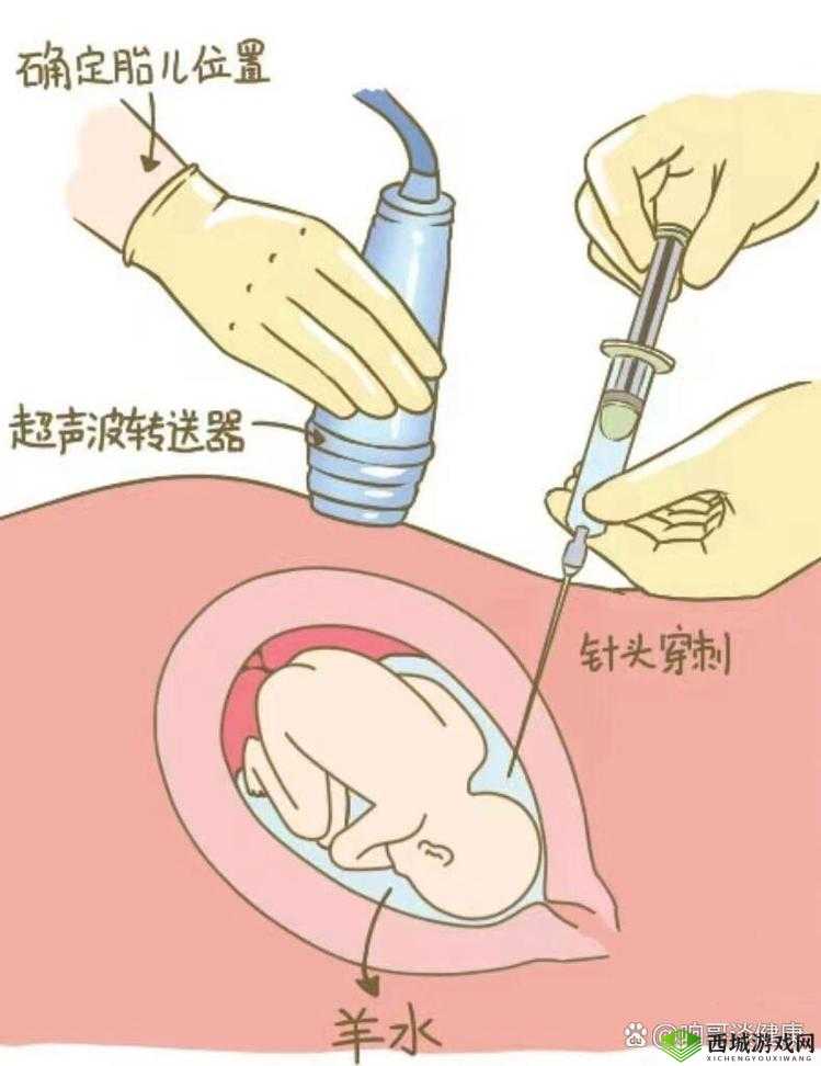 如何正确进行日羊插羊水门操作?